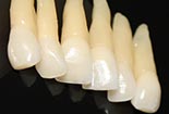 Morphologie in Vollkeramik